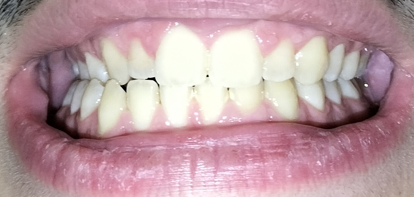 IMG 20240708 034545