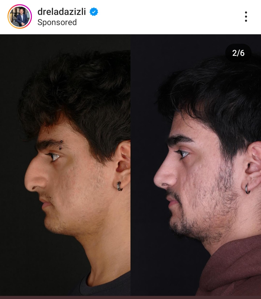 Screenshot 20240710 023436 Instagram
