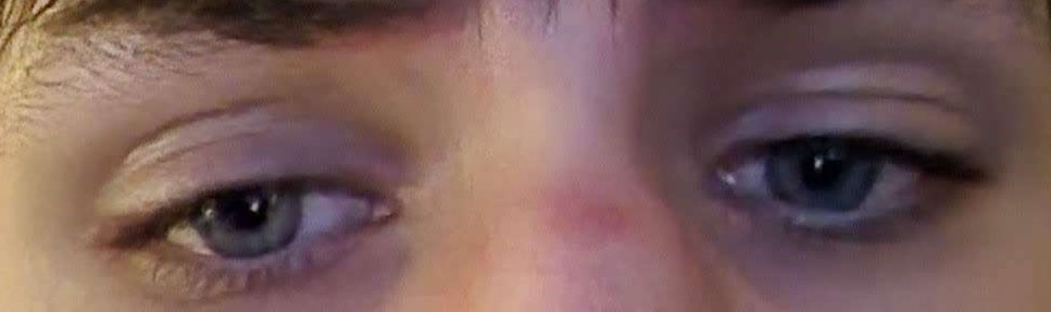Eyeareabefore