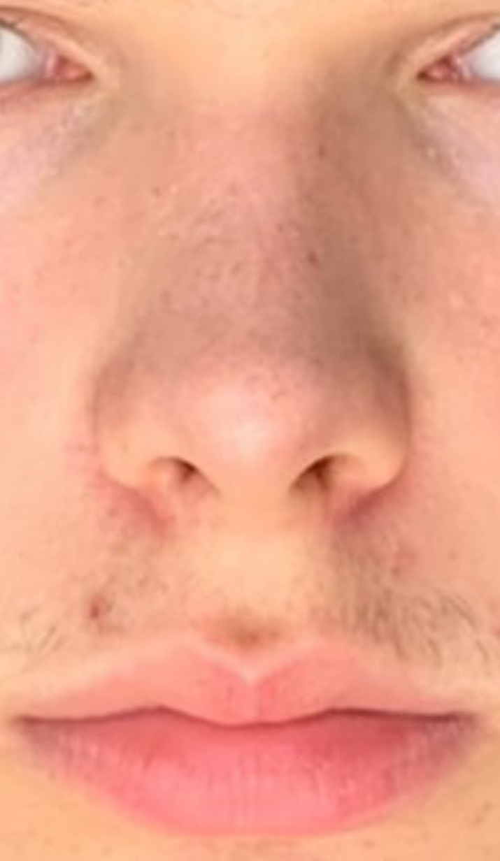 IMG 1181