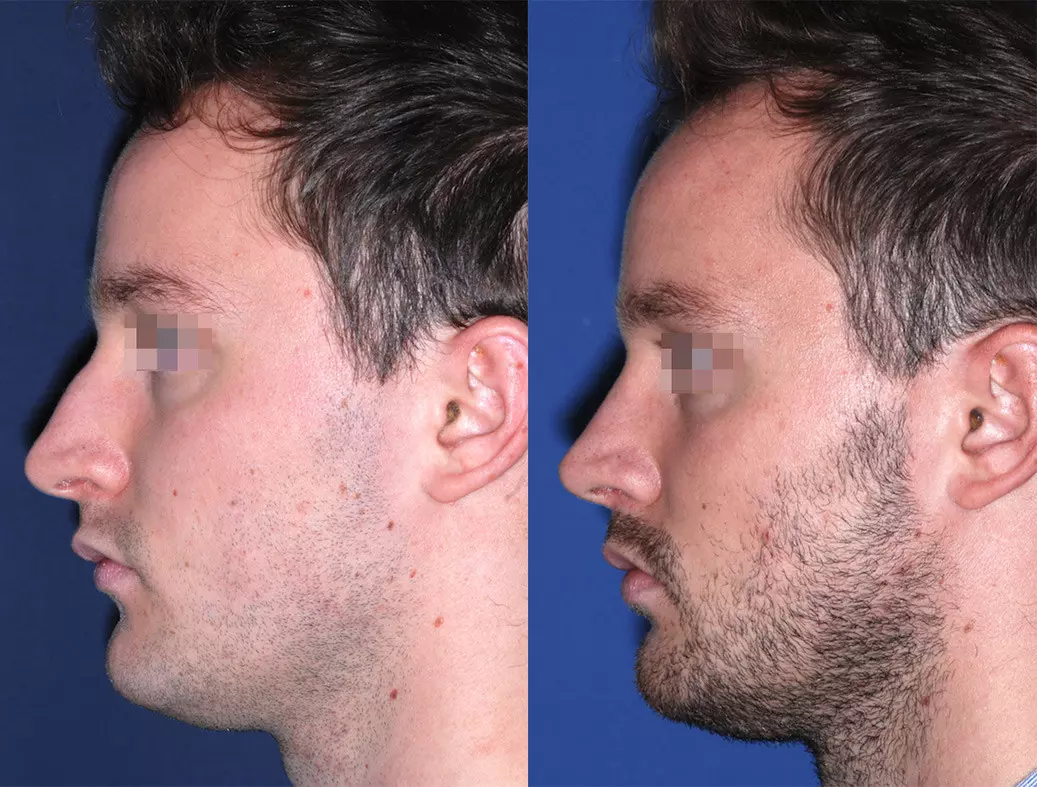 Male4f