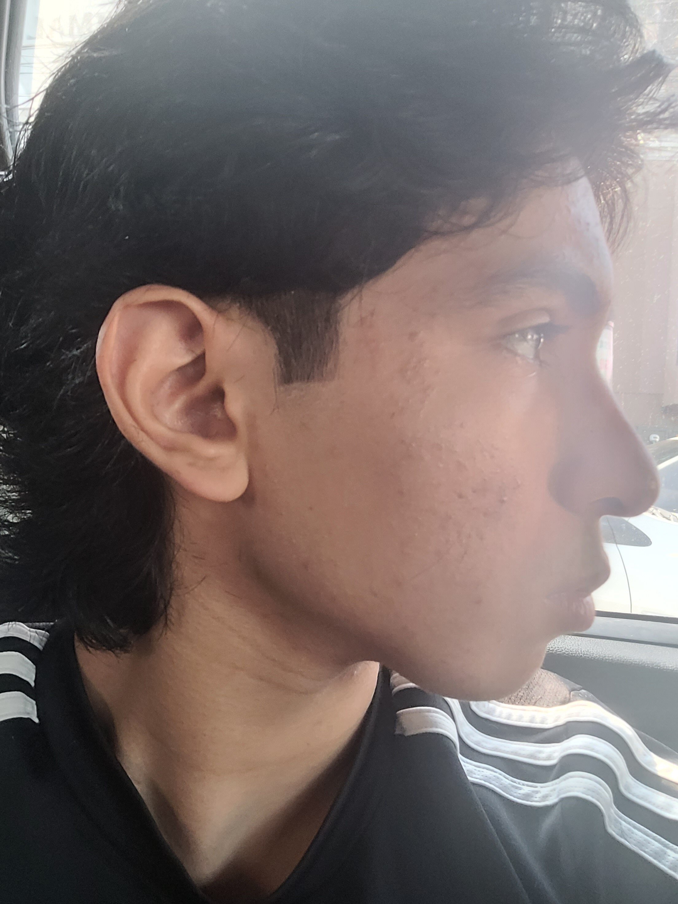20240726 155626