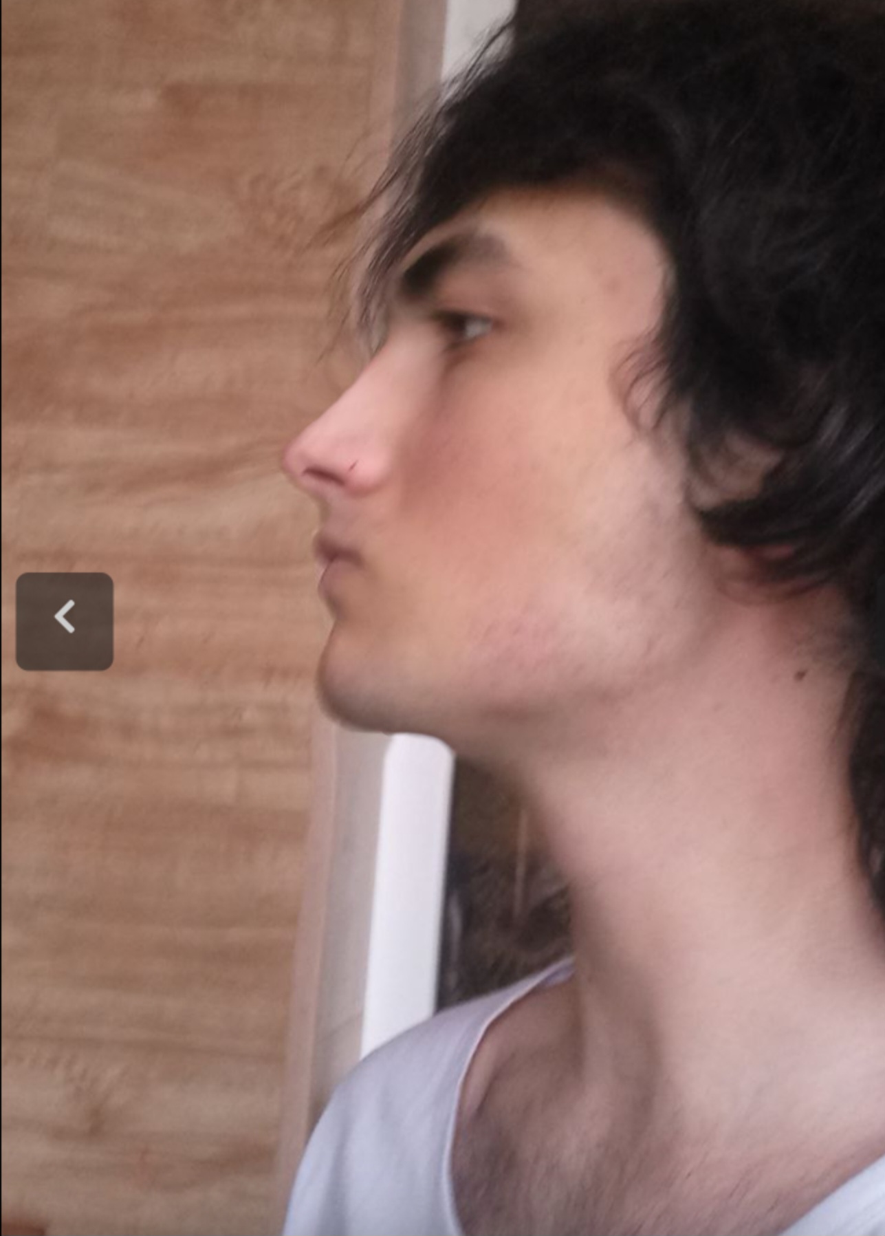 Screenshot 20240728 204727 Plastic Surgery Simulator lite