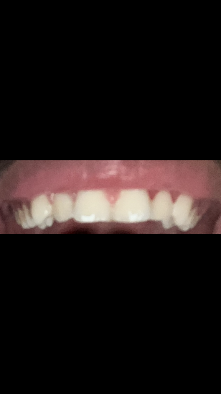 A584F1C1 AFBC 40D3 BB68 99C346FDF324 A584F1C1 AFBC 40D3 BB68 99C346FDF324