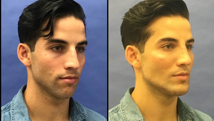 Images   2024 07 30T121947198