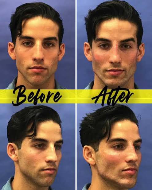 Images   2024 07 30T121952027