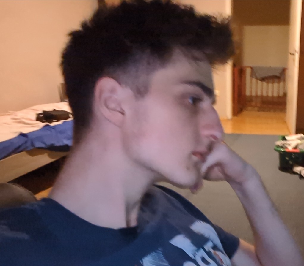 1000000217 1000000217