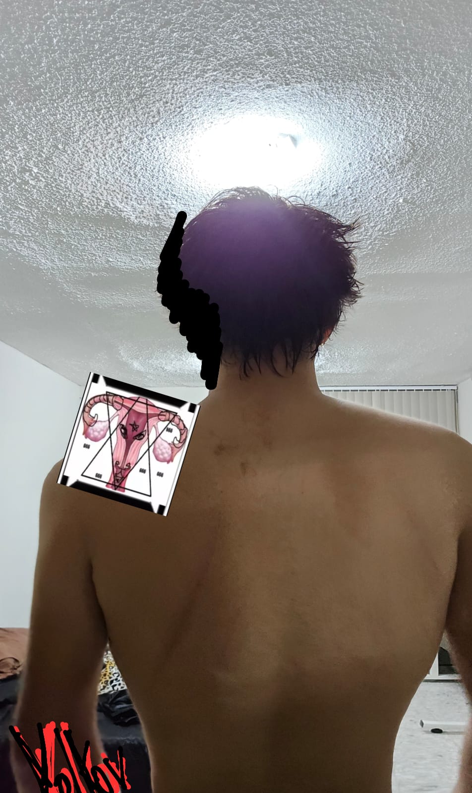 1000356440
