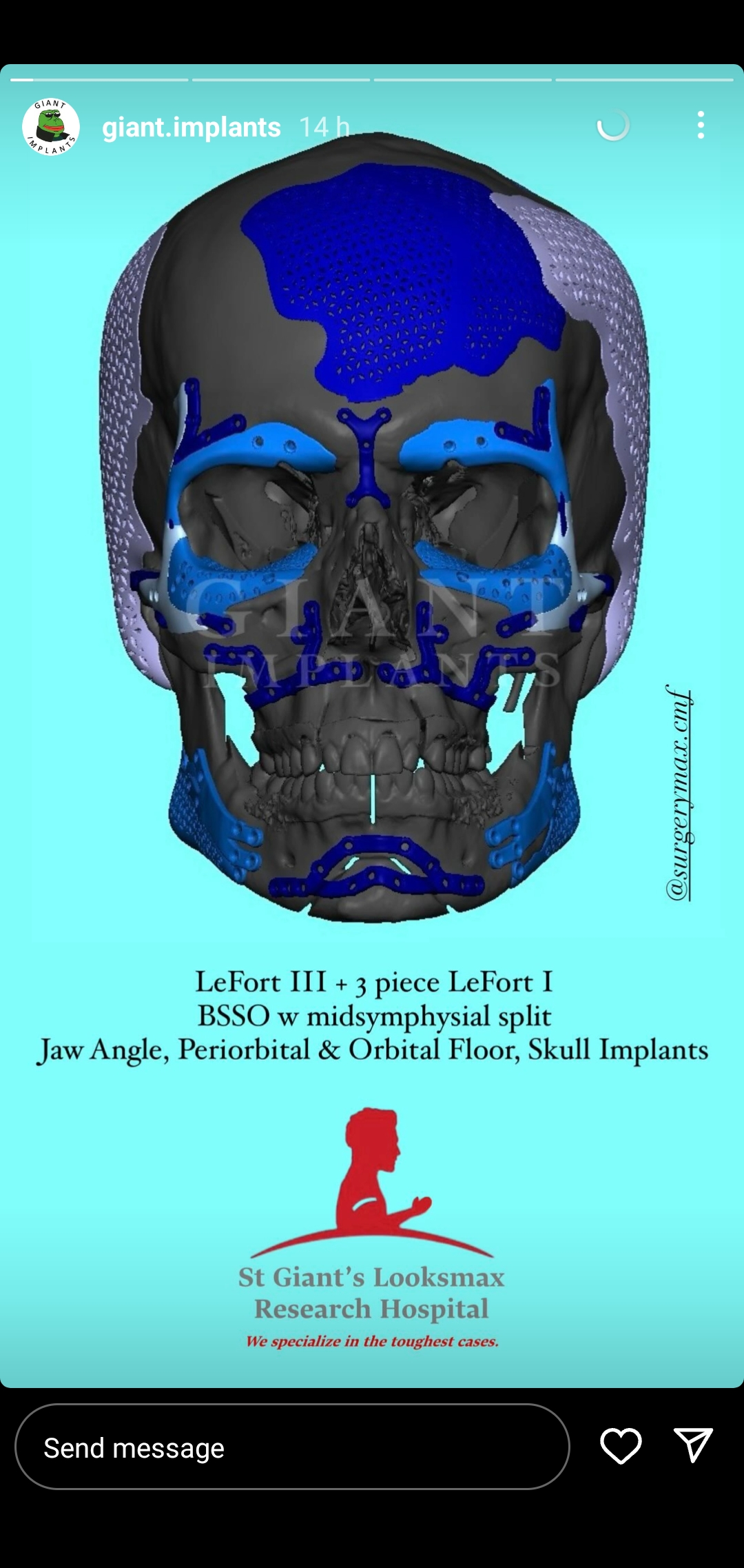 Screenshot 20240803 095730 InstaGold