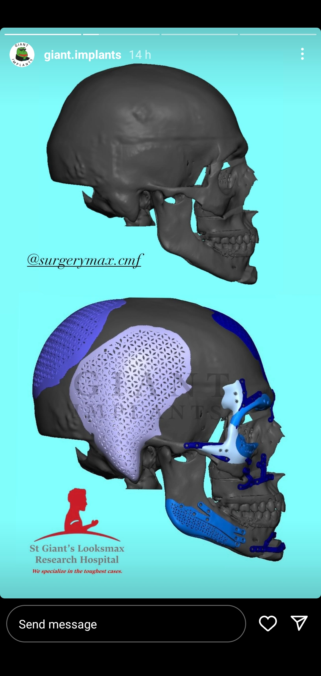 Screenshot 20240803 095743 InstaGold