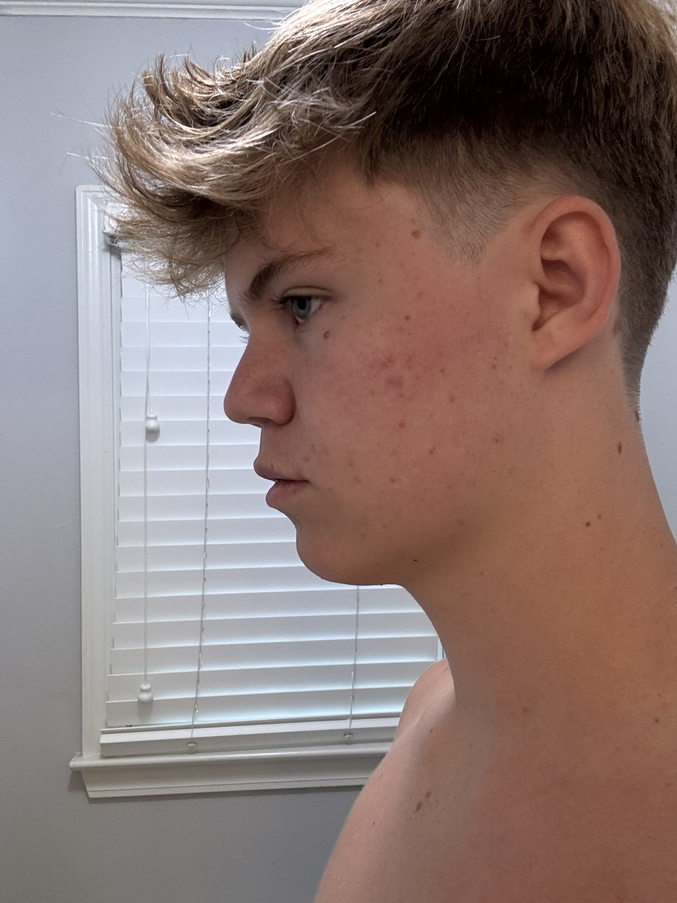 IMG 4523