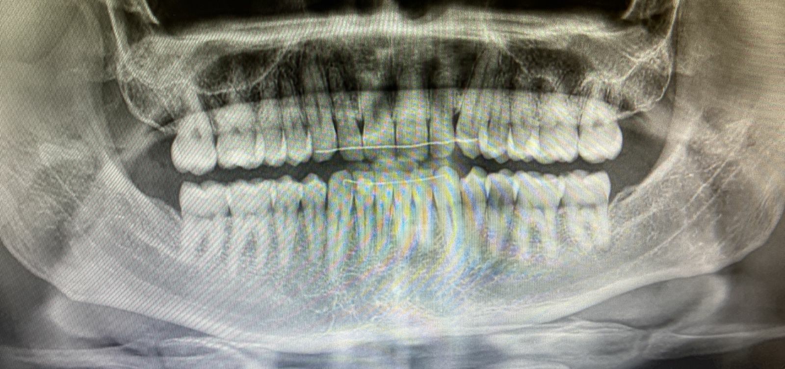 IMG 20230802 WA00032