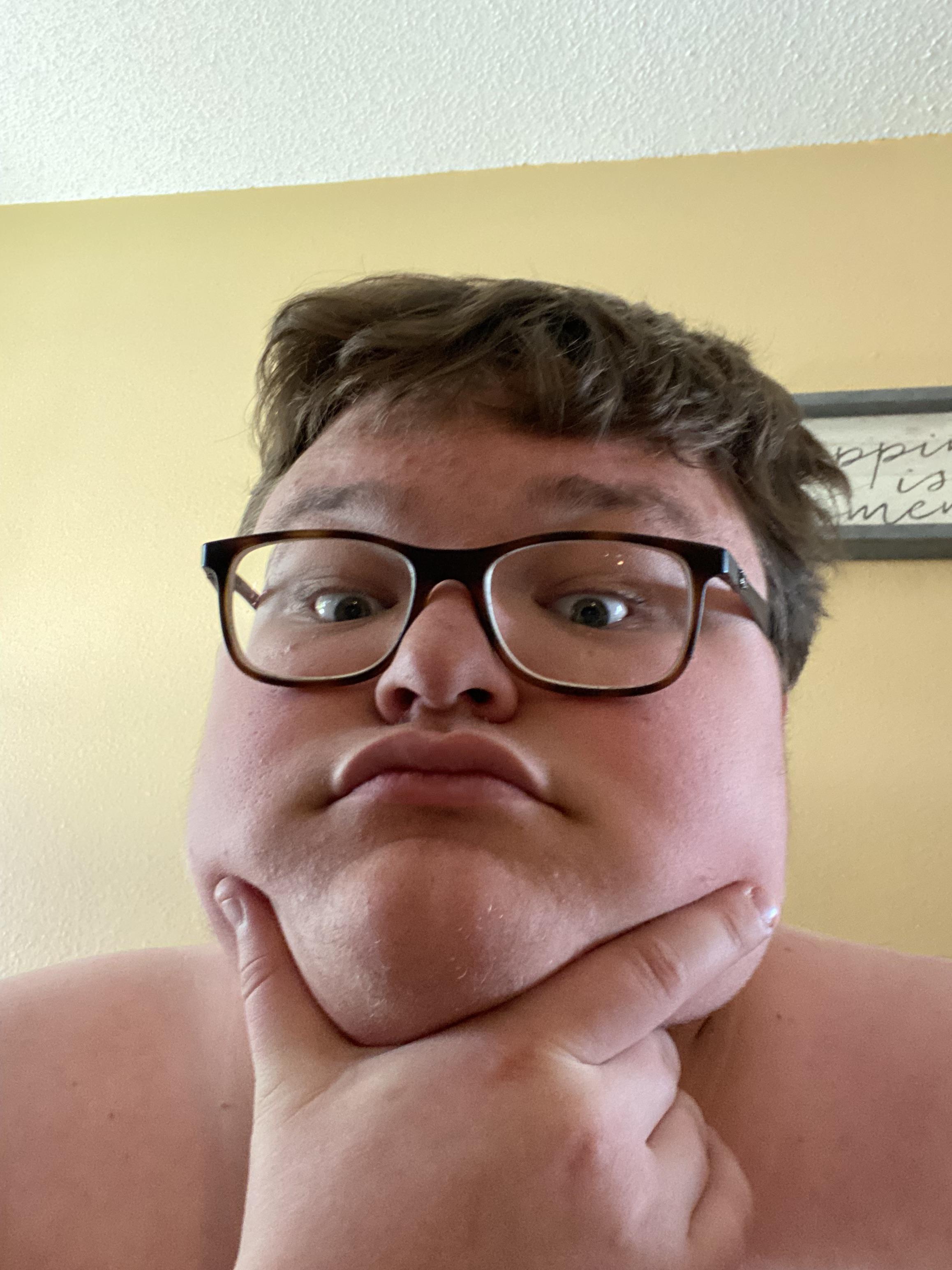 Am i ugly 20 male v0 or9lf6s6vu3b1