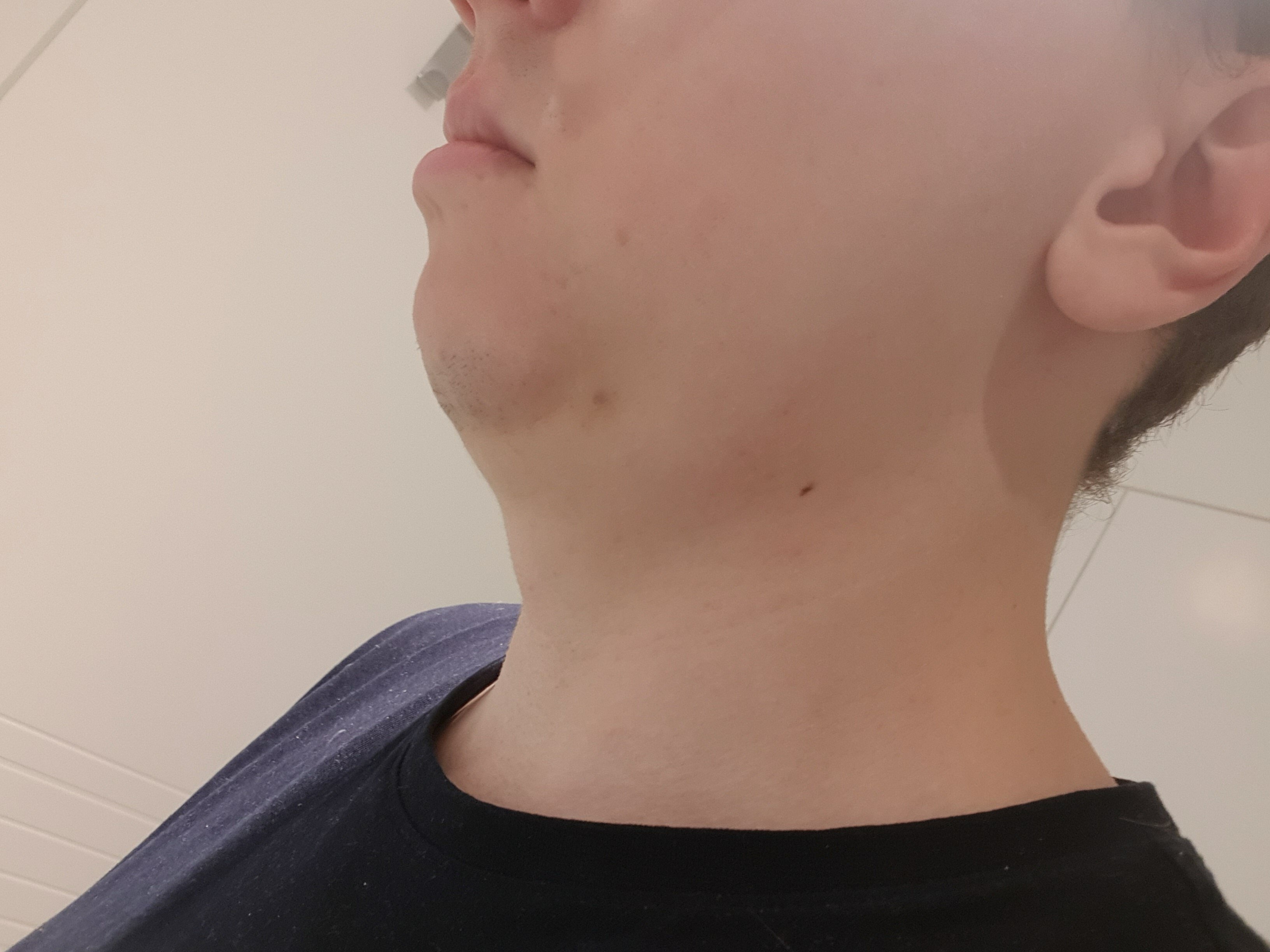 5 5