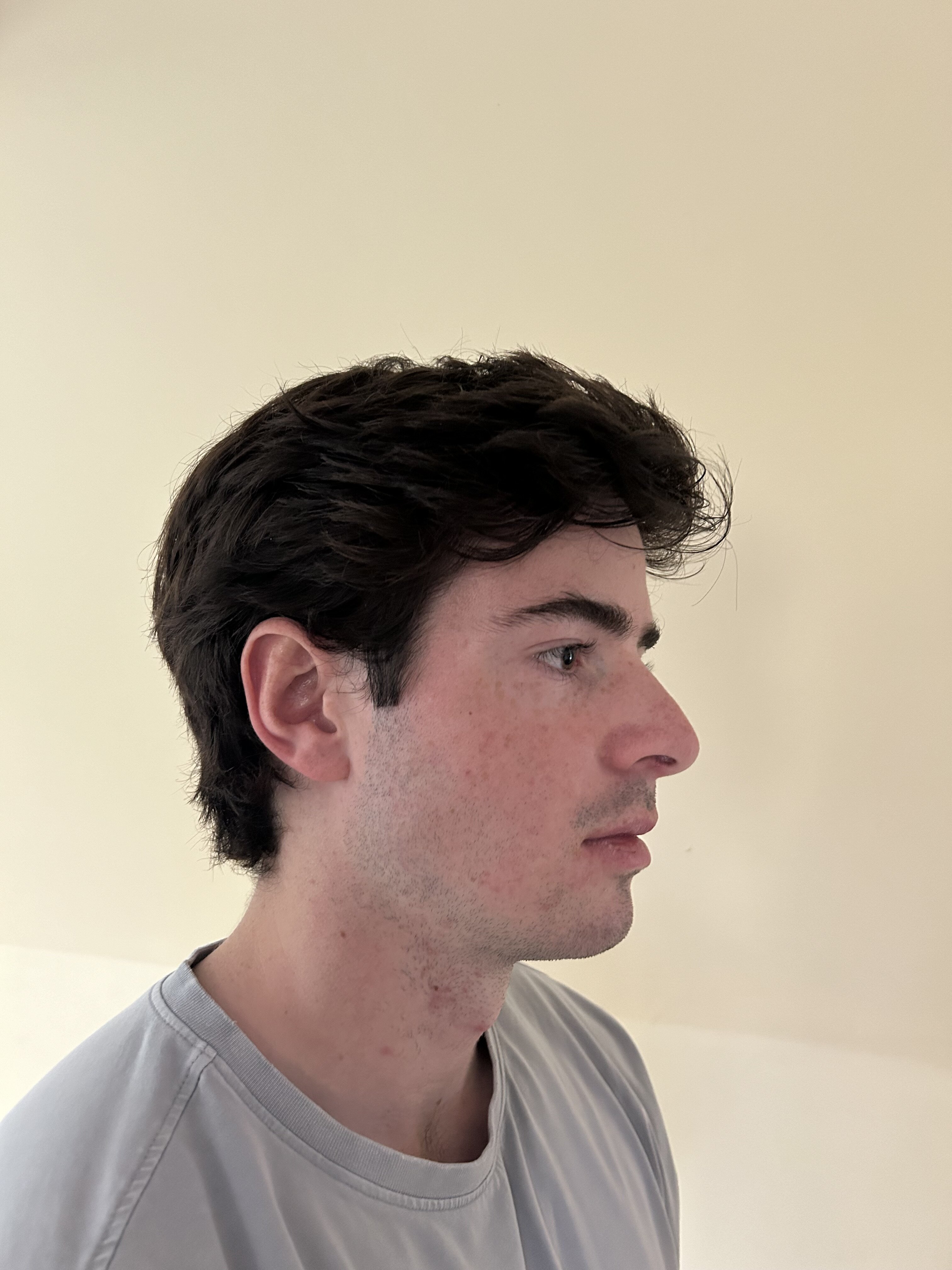 IMG 0741