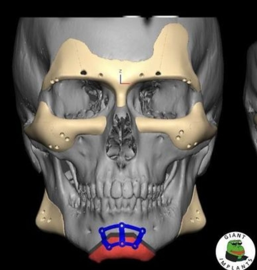 Screenshot 20240801 163321 Photos