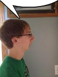 CHINLESS KID