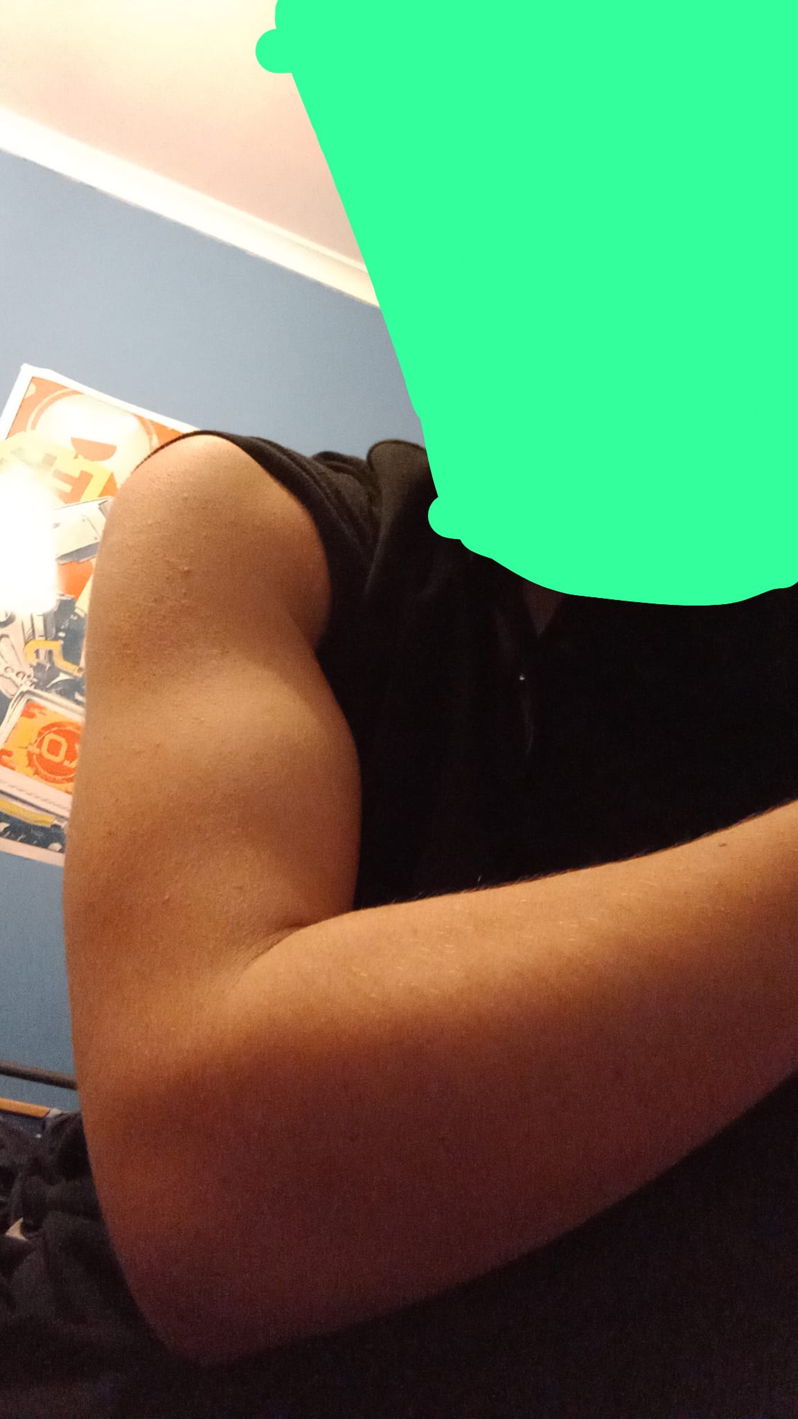 Bicep2024 08 22 at 011357 5bc509a7 Bicep2024 08 22 at 011357 5bc509a7
