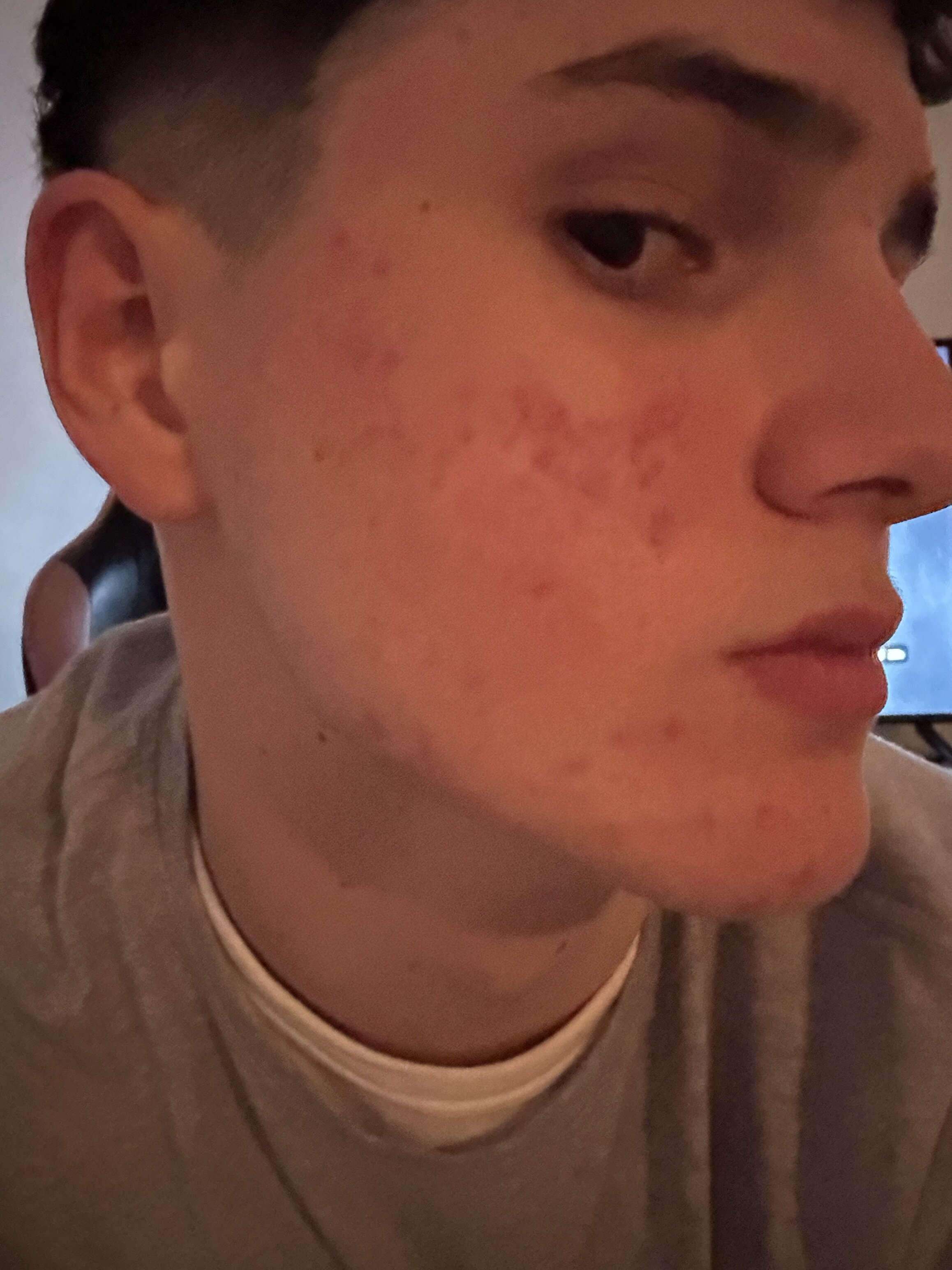 IMG 0672