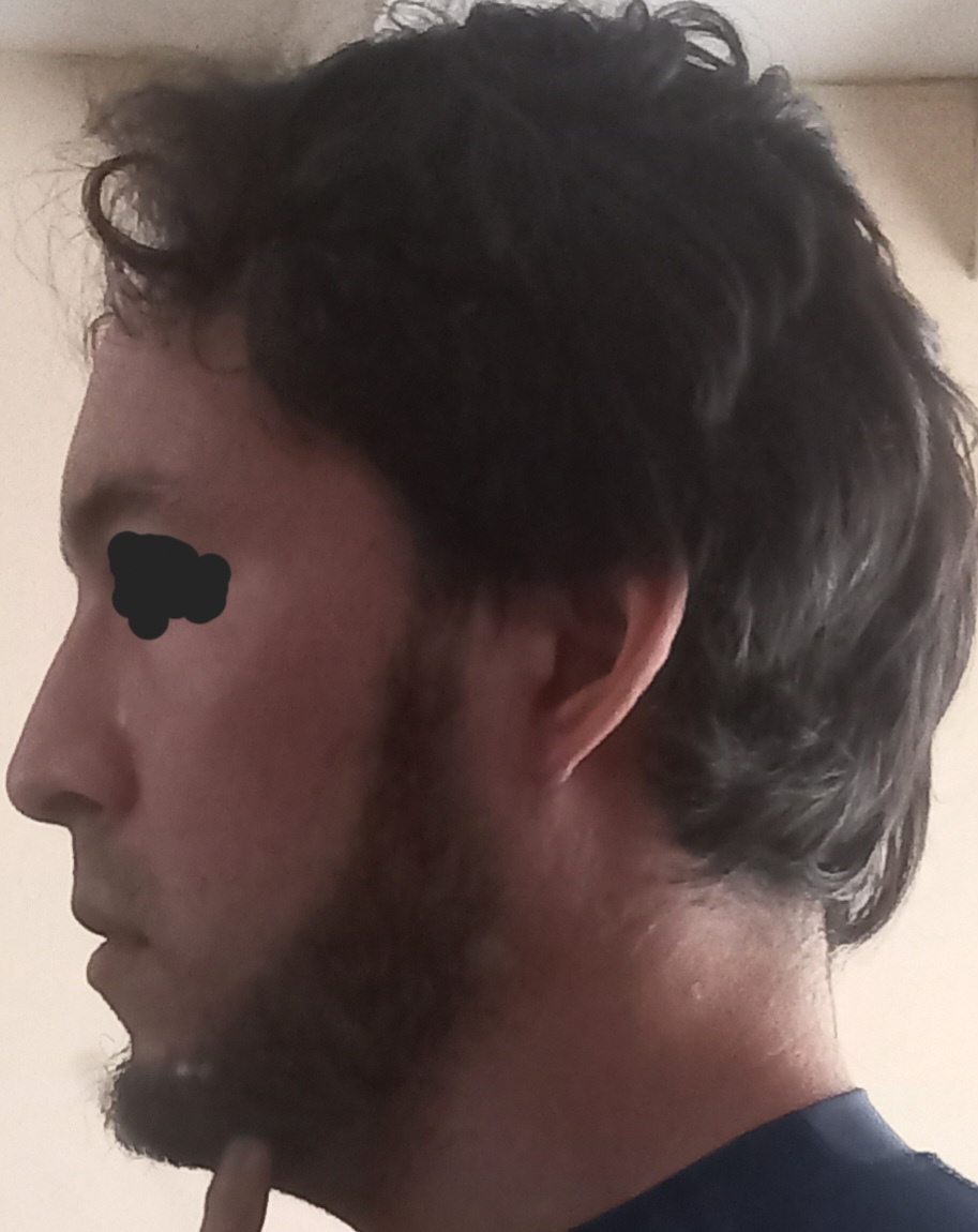 20240825 115729 1