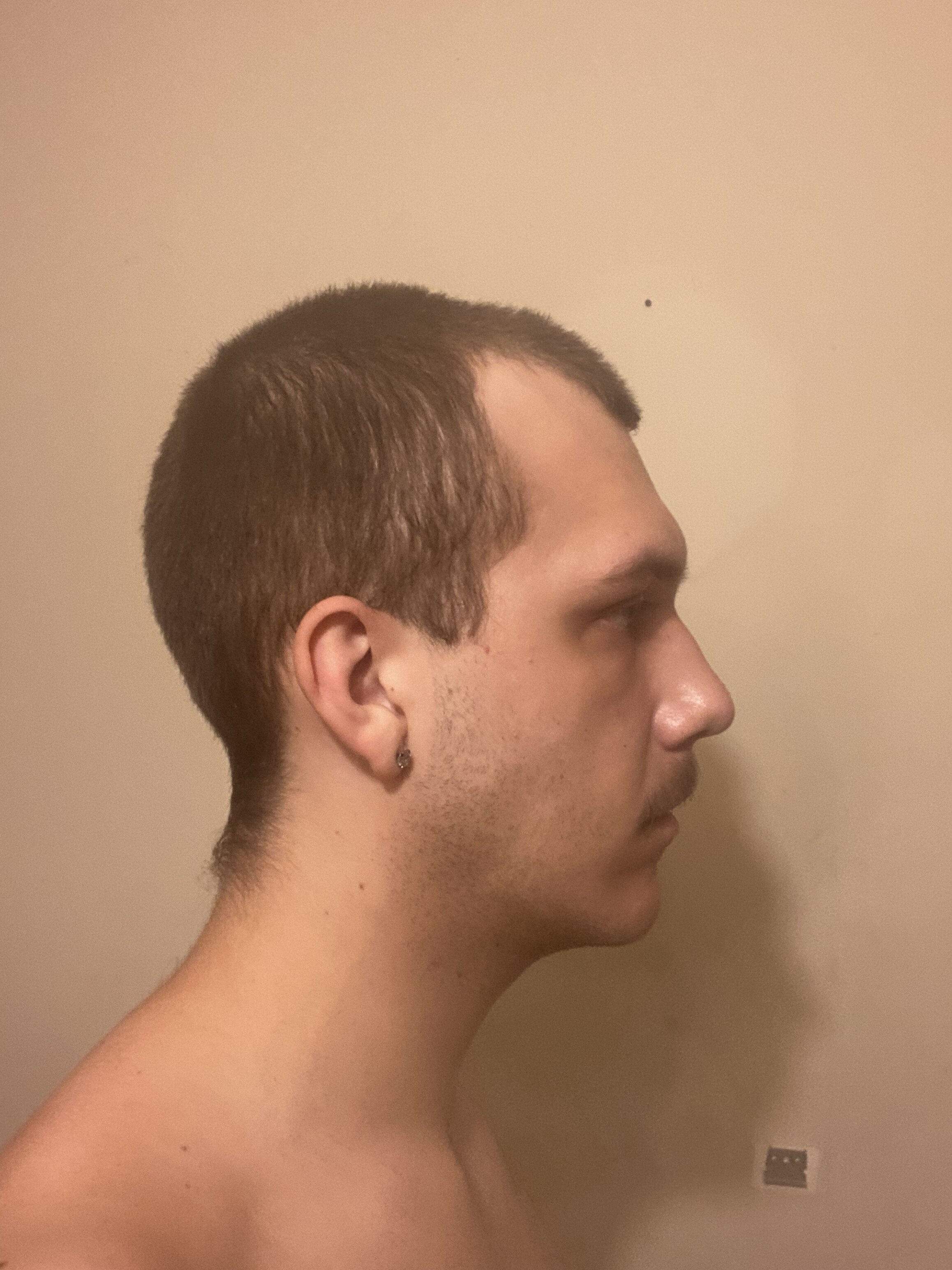 IMG 0793