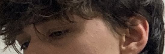 IMG 1741