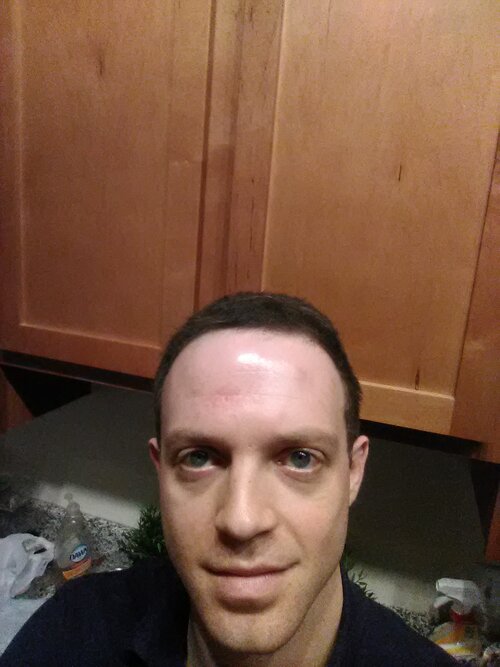 IMG_20171118_161812.jpg