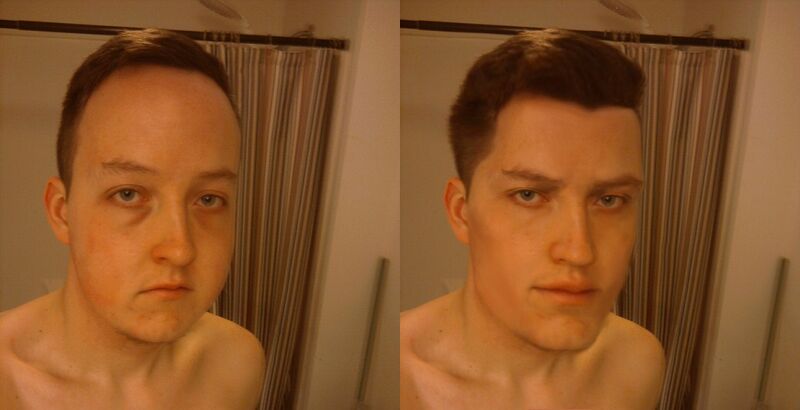 800px Millimeters of bone