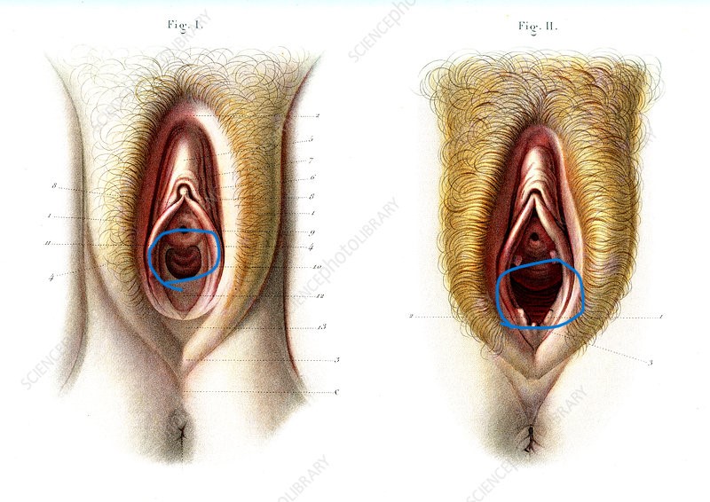 C0270027 Virgin and non virgin vulva anatomy