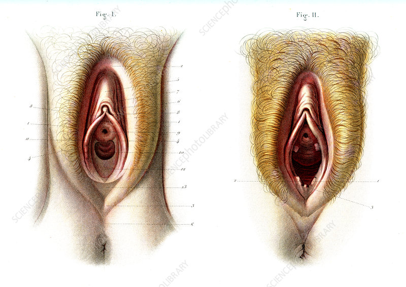 C0270027 Virgin and non virgin vulva anatomy 1