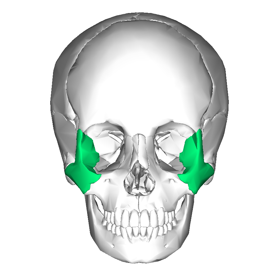Zygomatic bone anterior Zygomatic bone anterior