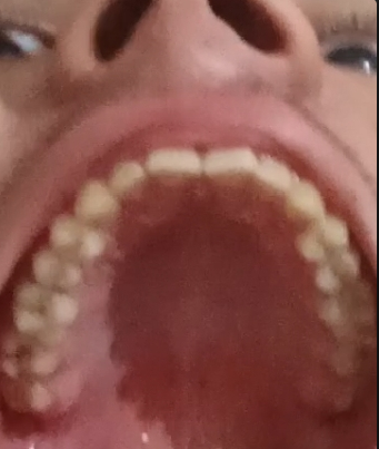 1725462314745