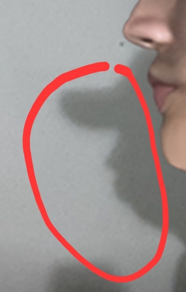 1000004091