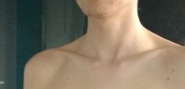 Neck0 Neck0