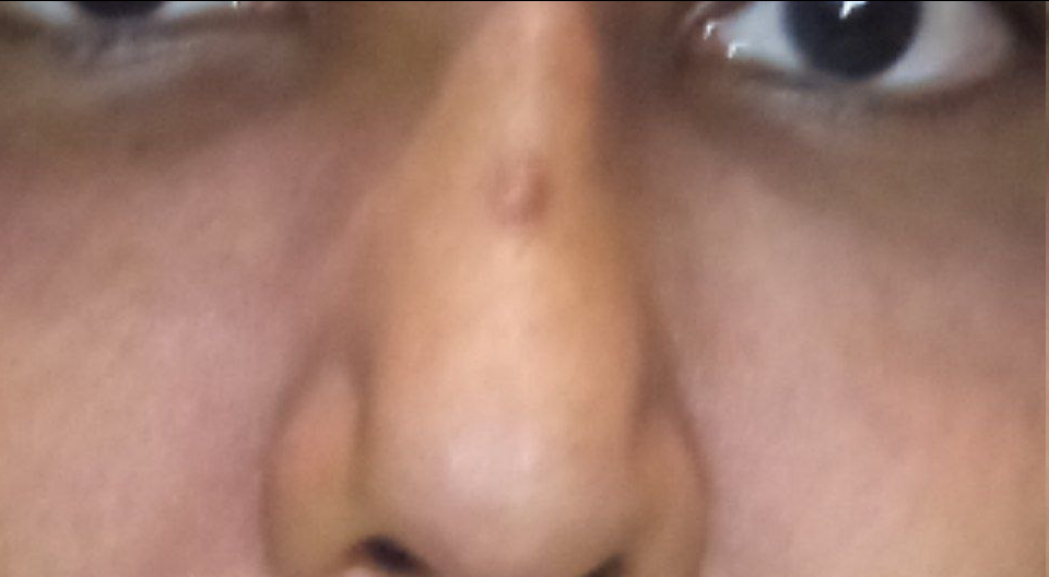 1725725026038