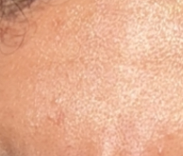 IMG 7710