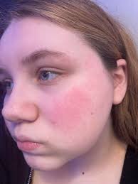 IMG 0920