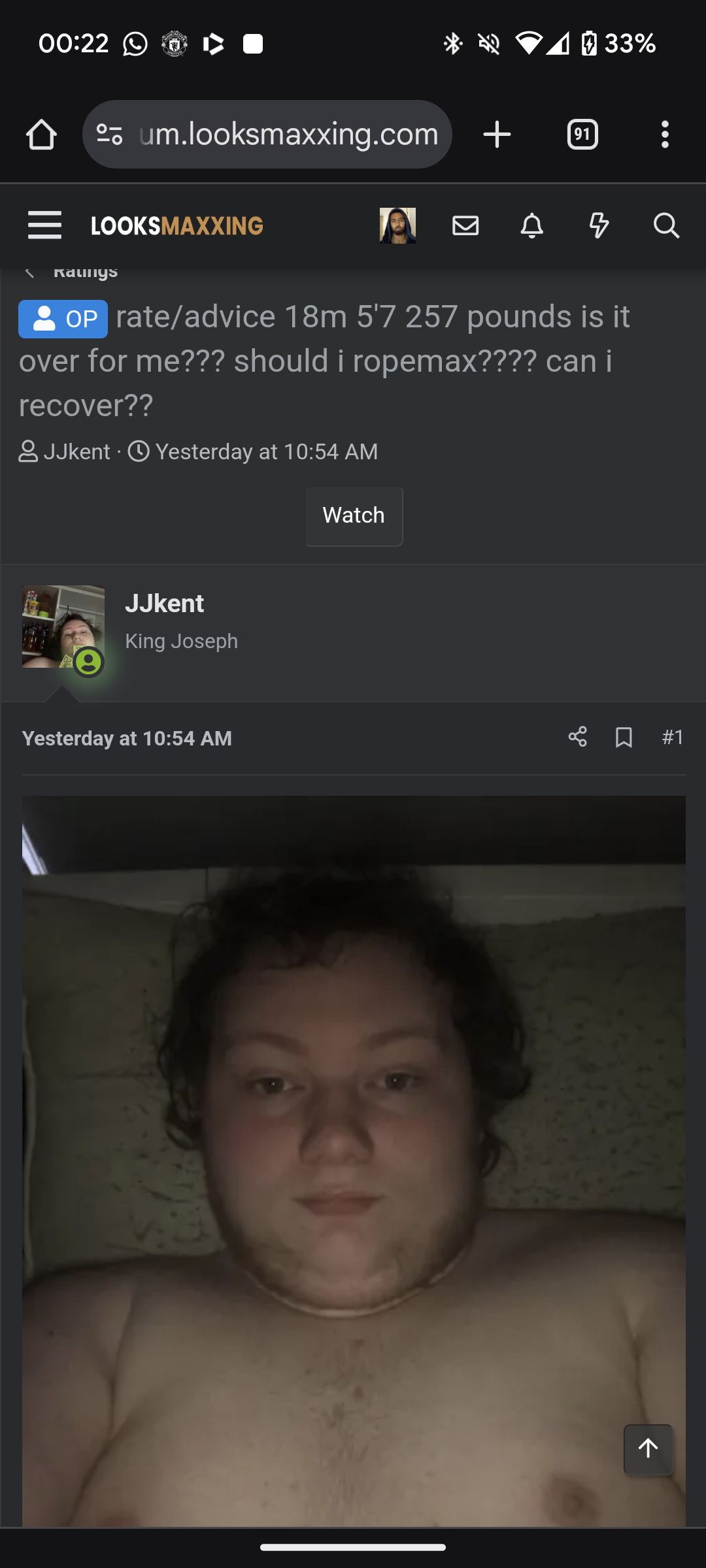 1000057144
