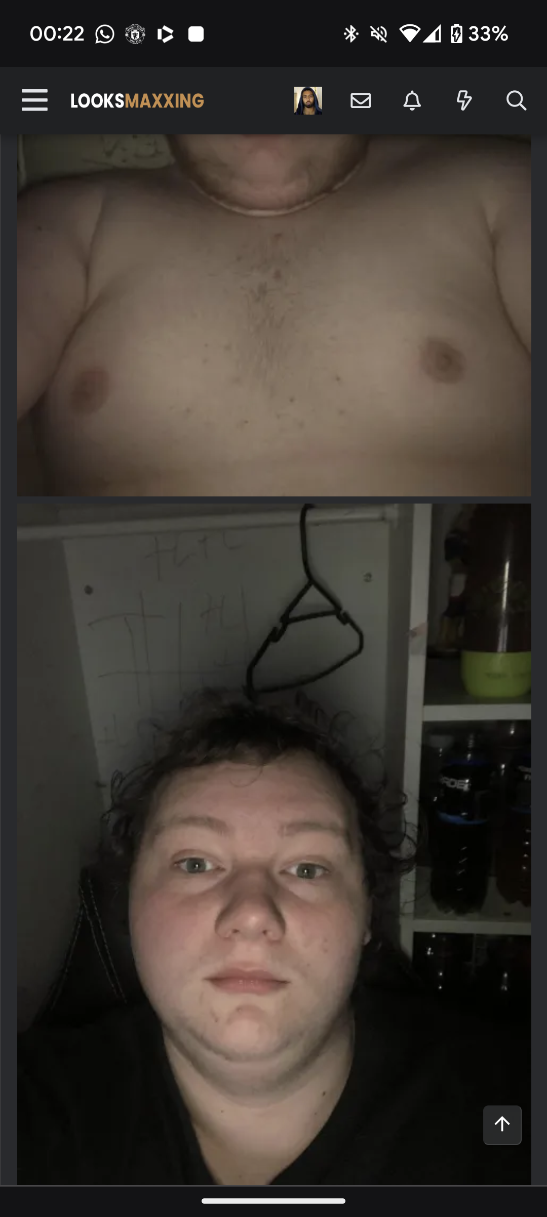1000057145