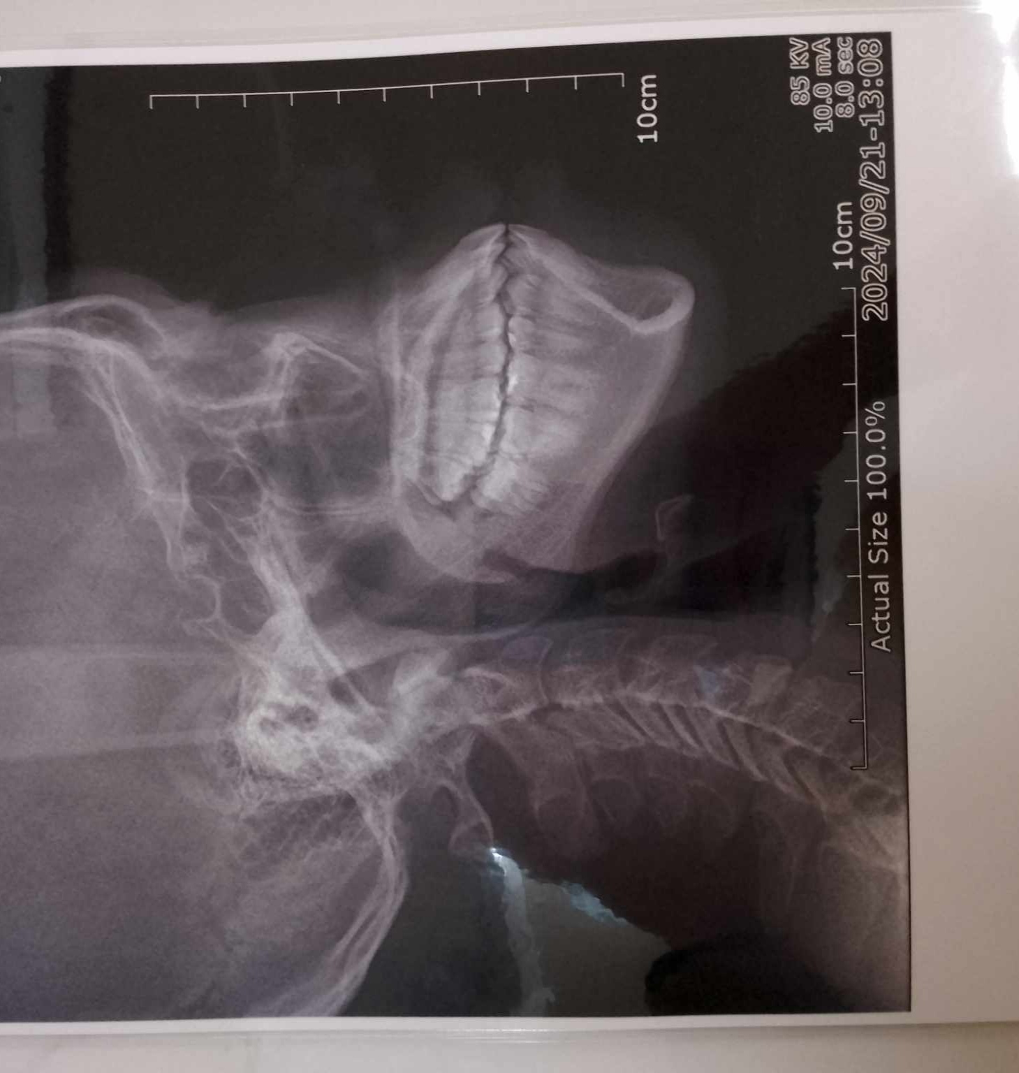 IMG 20240921 150731 IMG 20240921 150731