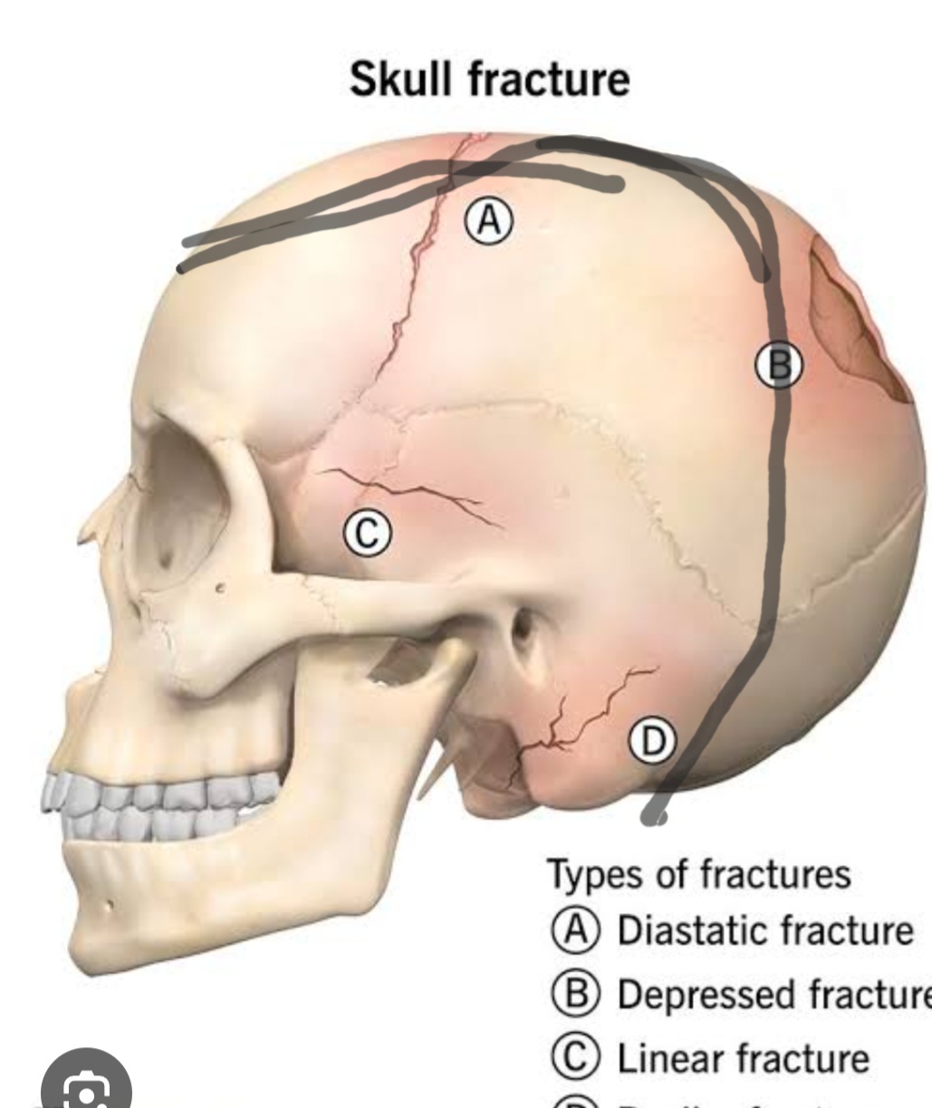 Screenshot 20240925 135206 Chrome