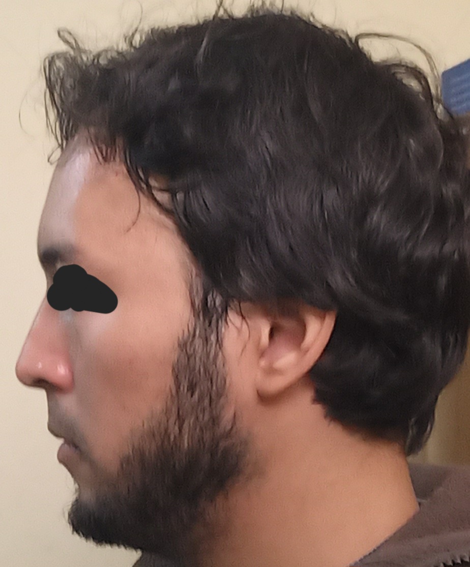 20240928 111204 1