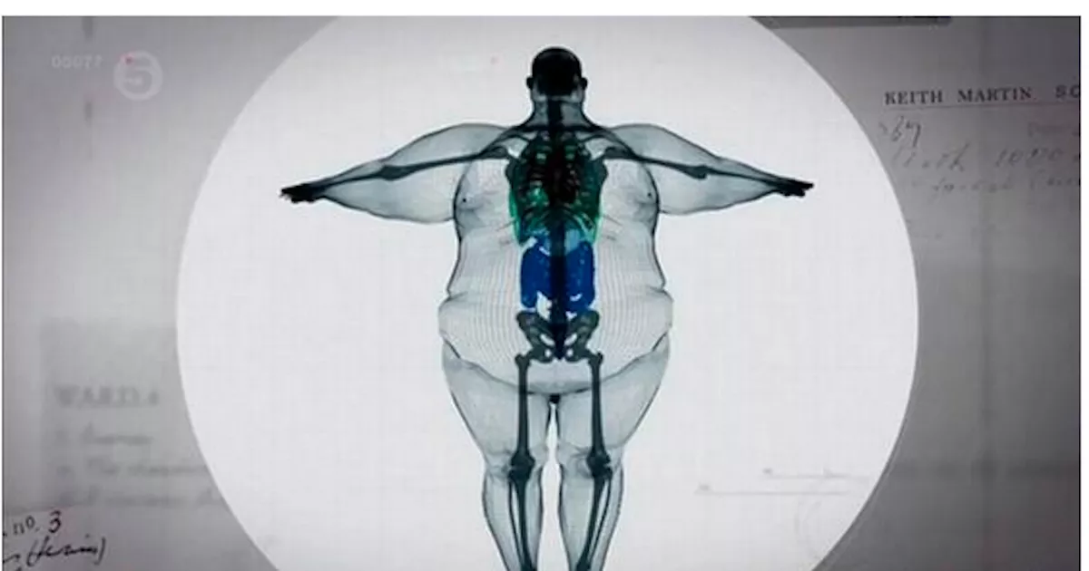 FAT MRI