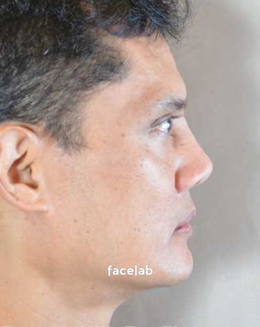 Facelab 2024 10 03 03 30 34