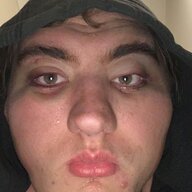 1000113237
