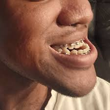 1728854620237