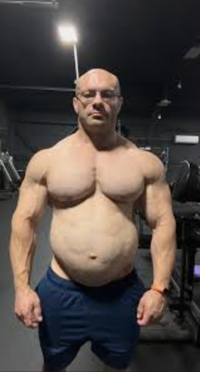 1000042413