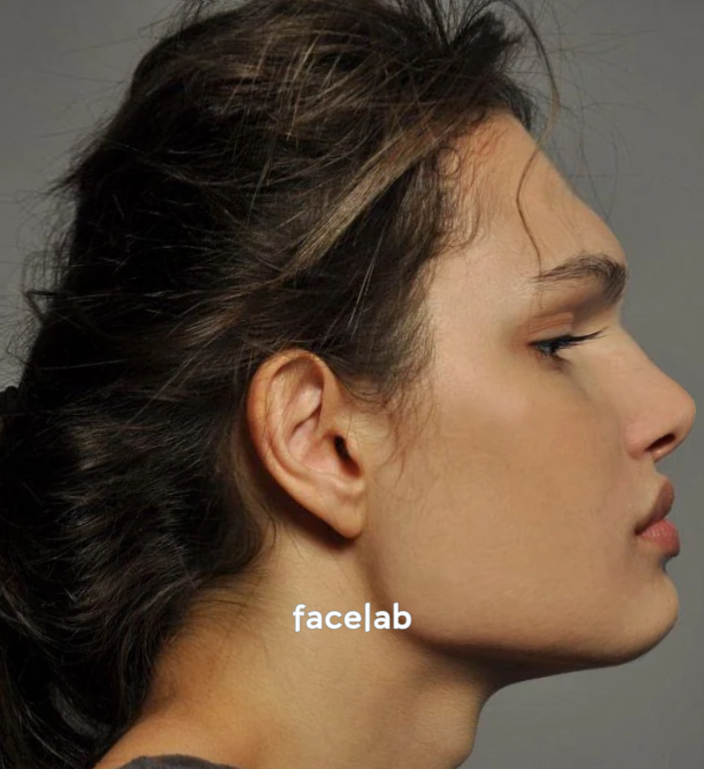 Facelab 2024 10 18 08 24 52