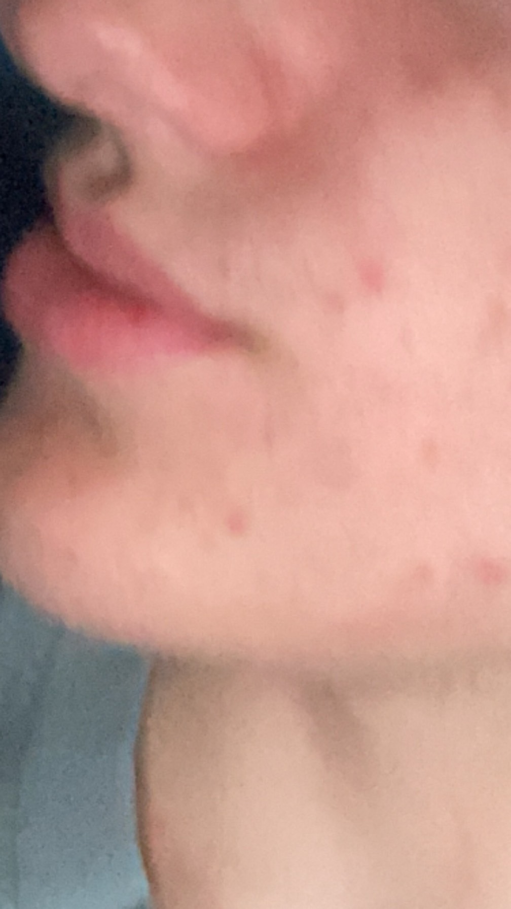 IMG 0899