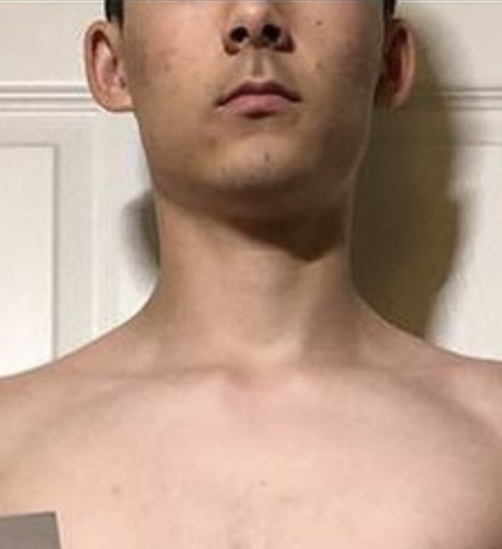 IMG 1138